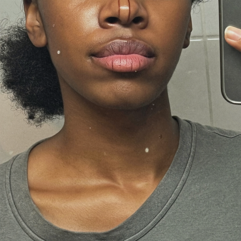 Before — sarah d.